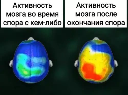 Активность мозга